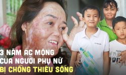 Người phụ nữ bị chồng tưới xăng thiêu sống, bỏng 92%: “3 năm qua giống như một cơn ác mộng, em đau lắm nhưng phải sống vì con”